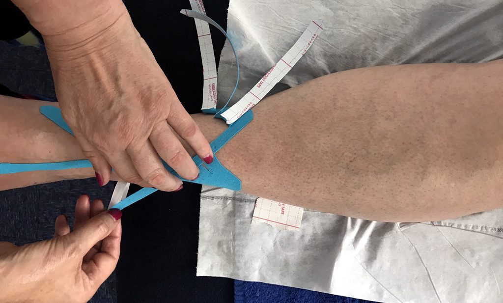 kinesiology taping ankle with blue tape